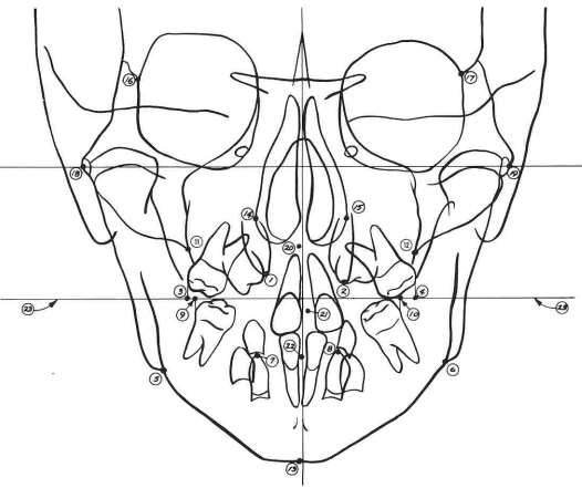 Manual Illustration